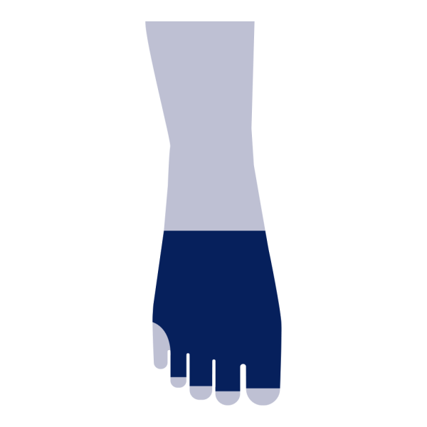 ToeCap (półstopka)